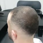 Hair density 1 - best hair fibers brands ( buying guide )