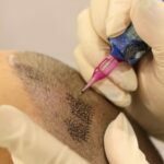 Micro pigmentation