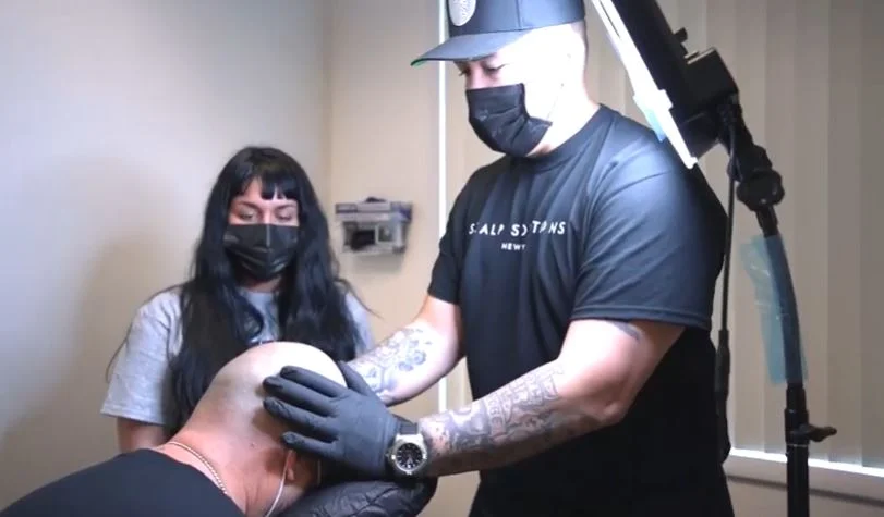 Scarl micropigmentation training