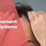 Replacement hair systems