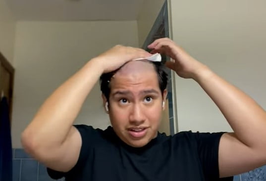 Best glue for hair systems