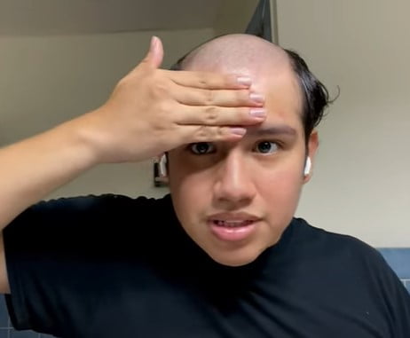 Best glue for hair systems