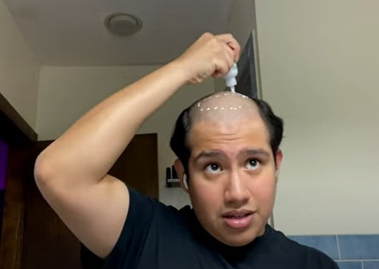 Best glue for hair systems