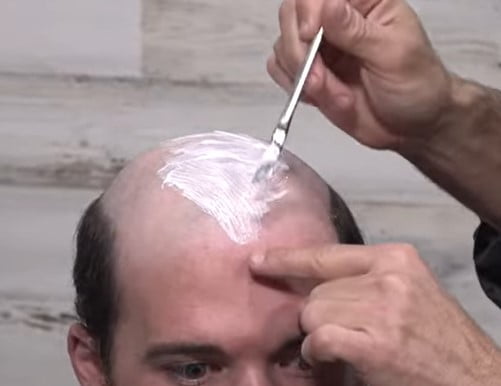 Are hair systems safe
