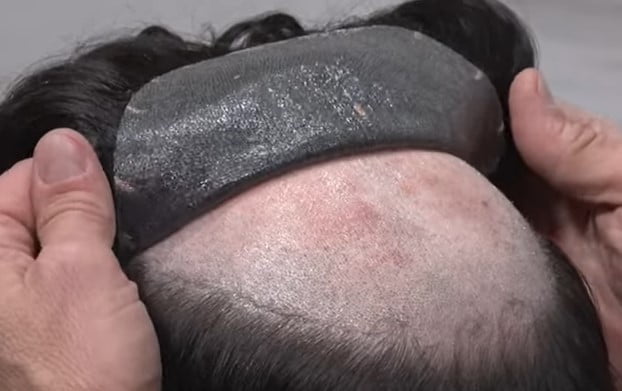 Are hair systems safe
