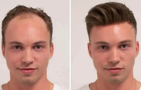 How do hair systems look in person 3 - how do hair systems look in person