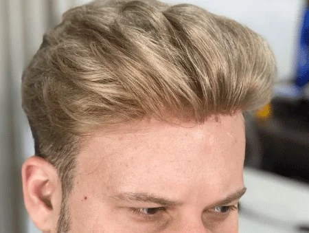 Replacement hair systems