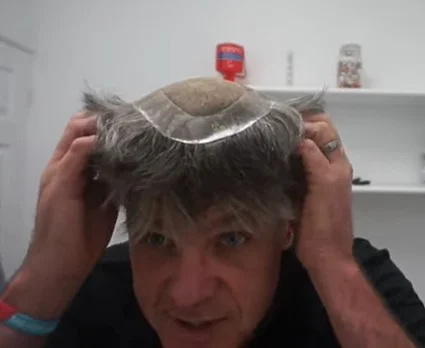 Replacement hair systems